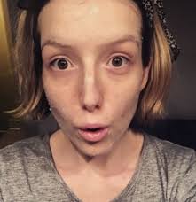 Health anxiety drove me to a breakdown"