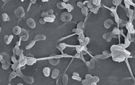 Image result for Mycoplasma