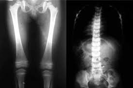 Hospital putrajaya is hospital located in the new government administrative area of putrajaya in sepang district, selangor. Https Www Moh Gov My Moh Resources Penerbitan Garis 20panduan Garis 20panduan 20umum Kkm National Radiology Services Operational Policy 1st Edition Pdf