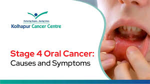 Image result for gum cancer symptoms