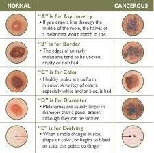 Basal cell carcinoma, squamous cell carcinoma and malignant melanoma. Types Of Skin Cancers Dermatologist Woodlands Houston Katy Texas