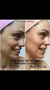 Rodan & Fields Independent Consultant