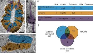 Observations on the caudal end of the spinal cord 4. Characterization Of Spinal Cord Ependymal Cells A C Immunoelectron Download Scientific Diagram