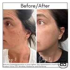 Meet Abbi: The Future of Personalized Skincare Skincare isn't  one-size-fits-all—so why settle for generic products? Abbi is 100%  customized skincare, powered by proprietary AI digital skin analysis.  Here's how it works: 🔅Take