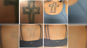 We are living in an age where things are easy and possible. Tattoo Regret New Techniques Make The Removal Process Easier Than You Think King5 Com