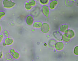 Image result for Dissotis brazzae