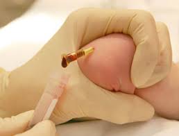 Image result for Difficult Intravenous Access in Children