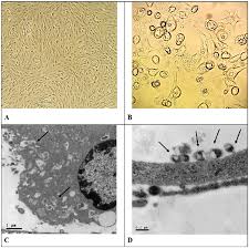 The 'vero' lineage was isolated from kidney epithelial cells extracted from an african green monkey (chlorocebus sp.; Morphological Aspects Of Vero Cells Infected With Zika Virus Zkv Download Scientific Diagram