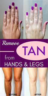 Pin On Skin Whitening