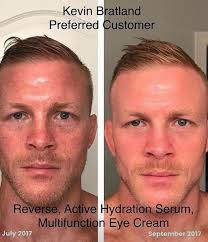 Pin By Bri Coles On Beauty Skin Concern Rodan And Fields Rodan And Fields Regimen Rodan And Fields Reverse