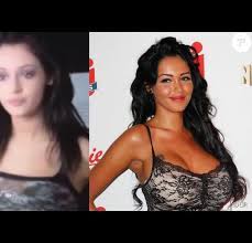 May 26, 2021 · cela faisait des années que nabilla en rêvait et c'est désormais chose faite. Nabilla Benattia Meconnaissable Dans Un Film Avant La Chirurgie Esthetique Purepeople
