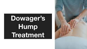 Check spelling or type a new query. How To Get Rid Of Dowager S Hump