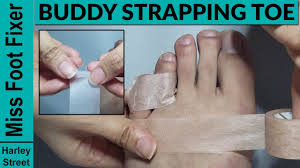 How to properly bandage your foot with a sprained pinky toe tiana allen www.thewellnesssanctuaryinc.com. A Doctor Injured Toe How To Buddy Strap An Injured Or Broken Toe By Miss Foot Fixer Youtube