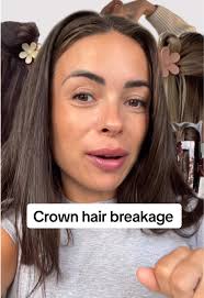 Claw clips causing breakage #creatorsearchinsights #howtofixbreakage  #crownbreakagehair #tipsforhaircare