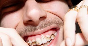 Daniël Declercq maakt grillz: 'Vaak komen mensen voor één of twee tanden,  maar het is natuurlijk leuker om out of the box te denken'