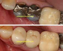 Pin On Dental Photos