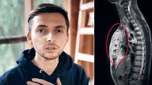 Maybe you would like to learn more about one of these? The Real Life Guys Warum Ein Bickenbacher Youtube Star Offen Uber Seine Krebserkrankung Spricht Hessenschau De Gesellschaft