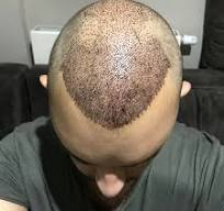 Royal Cosmetic Surgery