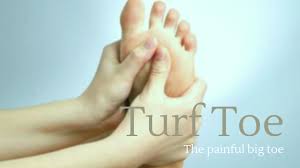Healthcare providers grade these injuries by their exercises can help stretch and strengthen your big toe. Painful Big Toe Turf Toe Well Heeled Podiatry Melbourne