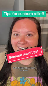Vinegar for Sunburn