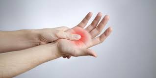 Les deux mains sont touchées de manière symétrique. Comprendre L Algodystrophie De La Main Apres Une Operation Du Canal Carpien