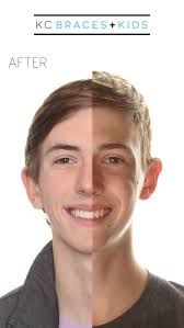 Happy Birthday Dr. Jared Christensen! Thank you for always being so fun and  caring to all of our patients. We are all grateful for your talents,  knowledge, and friendship.