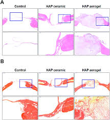 They were wrong!#tbone is a passion you can't stop! Highly Porous And Elastic Aerogel Based On Ultralong Hydroxyapatite Nanowires For High Performance Bone Regeneration And Neovascularization Journal Of Materials Chemistry B Rsc Publishing Doi 10 1039 D0tb02288h