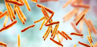 Que Es La Tuberculosis Sintomas Causas Y Como Tratar