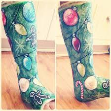 18 People Who Turned Their Casts Into Art Leg Cast Cast Decoration It Cast