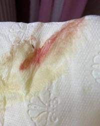 Blut Am Toilettenpapier 32 6 Achtung Bild Forum Schwangerschaft Urbia De
