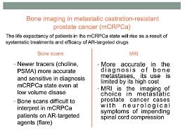 What are the symptoms of advanced prostate cancer and bone metastases? Bone Imaging In Metastatic Castration Resistant Prostate Cancer Where Do We Stand Bentham Science