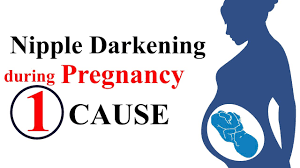We did not find results for: Skin Darkening During Pregnancy Areola Darkening And Increased Size Youtube