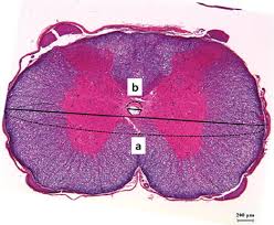 The spinal cord is part of the central nervous system (cns). A Rat Model Of Chronic Syringomyelia Induced By Epidural Compression Of The Lumbar Spinal Cord In Journal Of Neurosurgery Spine Volume 27 Issue 4 2017