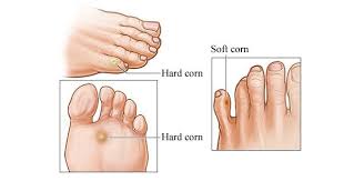 Pin On Health Remedies