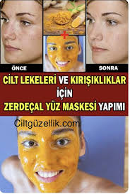 Zerdecal Maskesi Nasil Yapilir Cilde Faydalari Ve Zararlari Cilt Bakimi Zerdecal Cilt Bakimi Cil