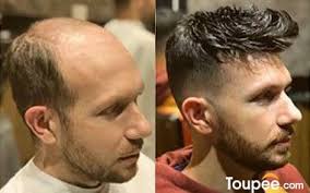 Lacey Harmon (bioruo4543)