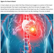 It often occurs among both men and women for up to 6 months prior to having a heart attack. One Month Before A Heart Attack Your Body Will Warn You Here Are The 6 Signs Steemit