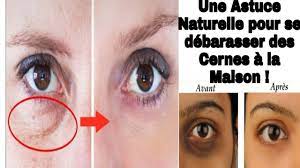 Le jus de pommes de terre (cru donc) est connu pour lutter contre l'acidité de l'organisme, il. Pomme De Terre Pour Eliminer Les Cernes Remedes A La Maison 100 Naturels Youtube