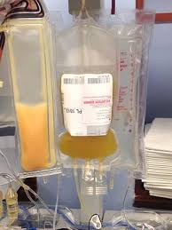 Image result for platelet donation