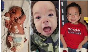 Fundraiser by Edna Guevara Vicente : Support Kediel & Family to make his  surgery possible.