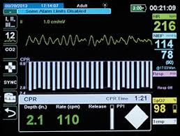 While Performing High Quality Cpr On An Adult, What Action Should You  Ensure Is Being Accomplished? - Quora