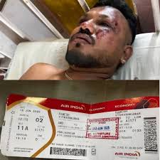 Ramesh Viswashkumar, único sobreviviente del accidente del vuelo 171 de Air  India, logró salvarse saltando del avión. Iba en el asiento 11A.