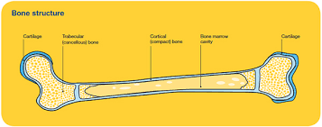 Bone marrow cancer develops when these cells replicate too quickly. Primary Bone Cancer Overview Cancer Council Victoria