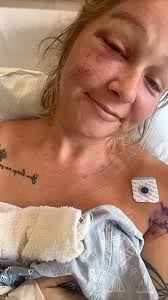 Fort Worth firefighter critically injured in house fire