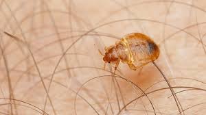 Industry leaders since 1950 nixalite offers an extensive line of professional products. How You Know You Have Bedbugs Everyday Health