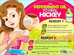 Mar 07, 2019 · how to hide a hickey with makeup. How To Get Rid Of Hickies Fast Top 10 Home Remedies