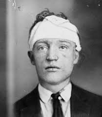 Richard “Peg Leg” Lonergan