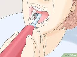 How long does it take the hole to close after tooth extraction? 4 Simple Ways To Clean Wisdom Teeth Wikihow
