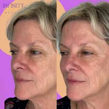 Infinity Dental Associates