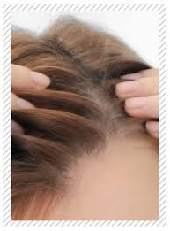 When looking for salons near me can be very frustrating for most people. Thinning Hair Solutions Angelo David